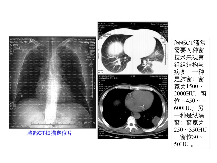 肺部CT技术（五月二十六）.ppt_第3页