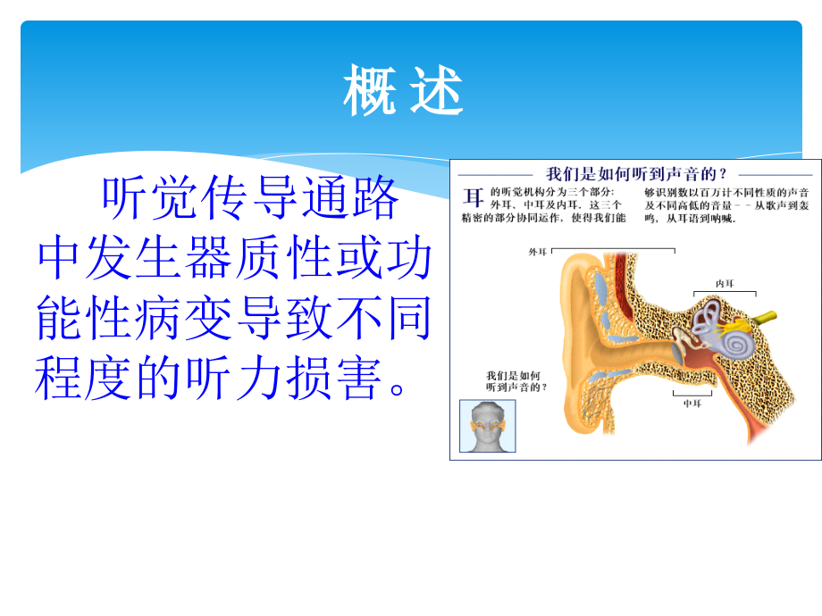 耳聋简介课件PPT_第4页