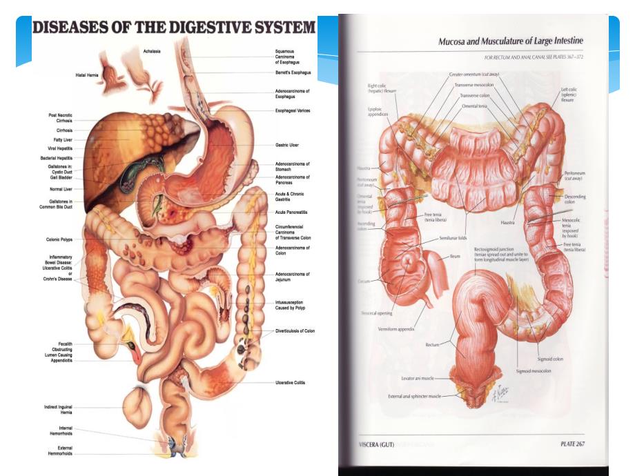 肠结核和结核性腹膜炎课件PPT_第4页