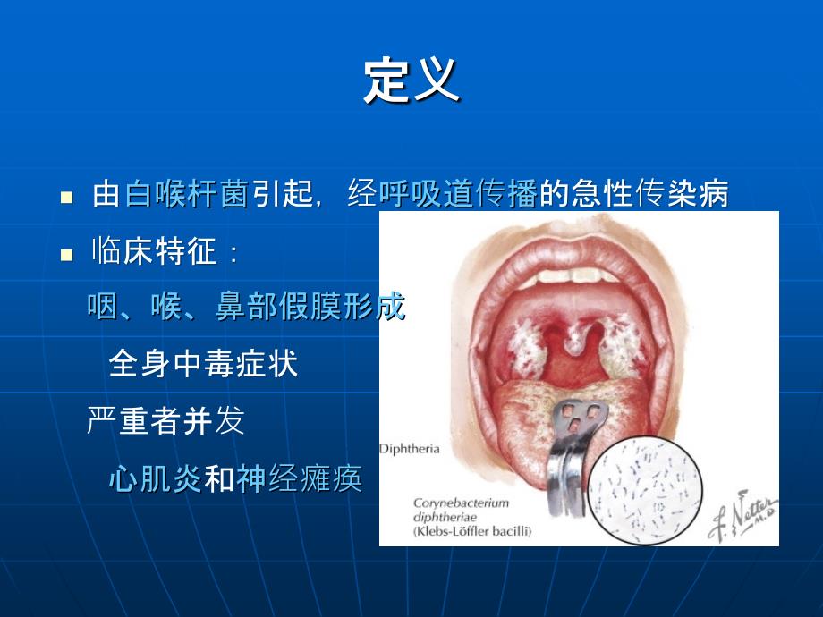 白喉课件PPT_第2页