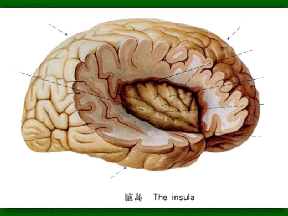 高教版断层解剖学PPT课件-3头部连续矢状断层解剖及MRI_第5页