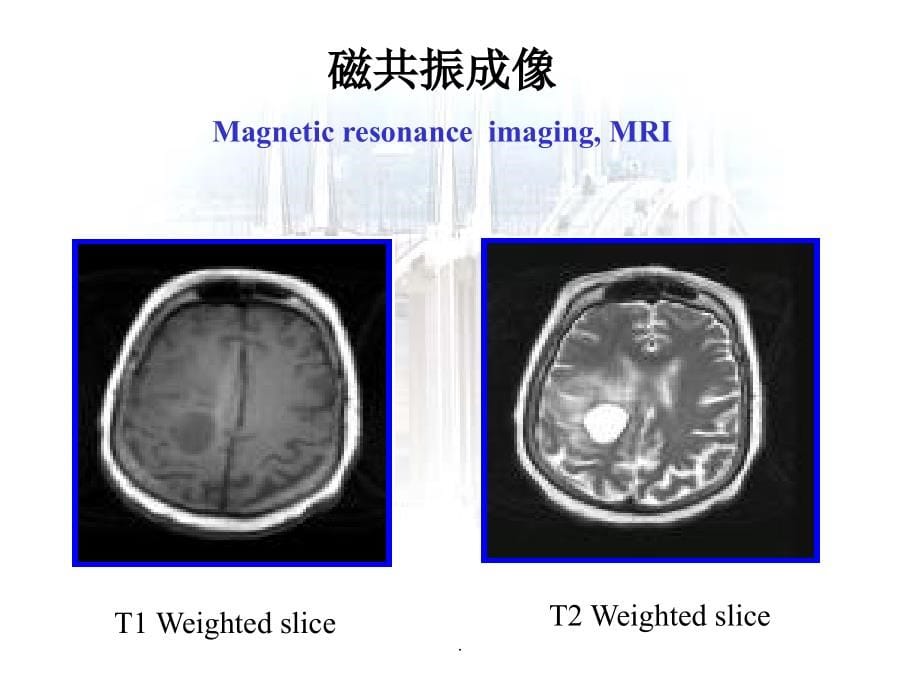 磁共振成像原理最新版本_第5页