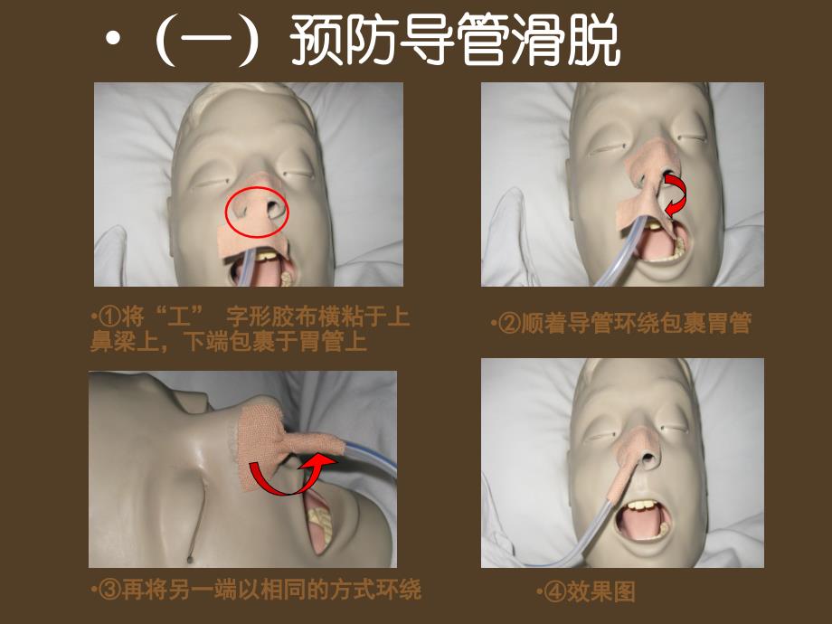 各类导管的护理课件PPT_第4页