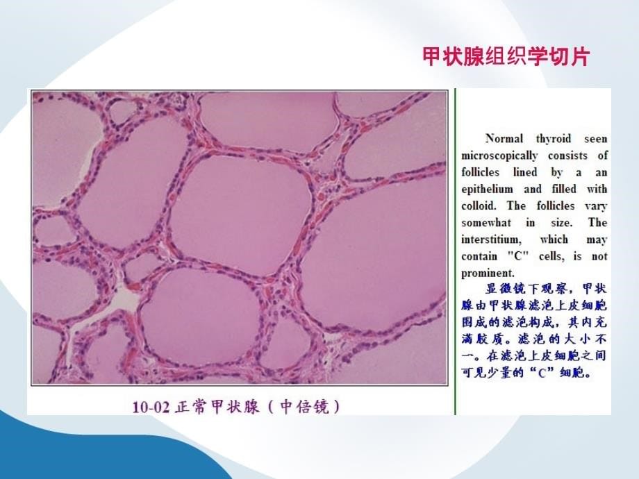 甲状腺结节(内训资料)课件PPT_第5页