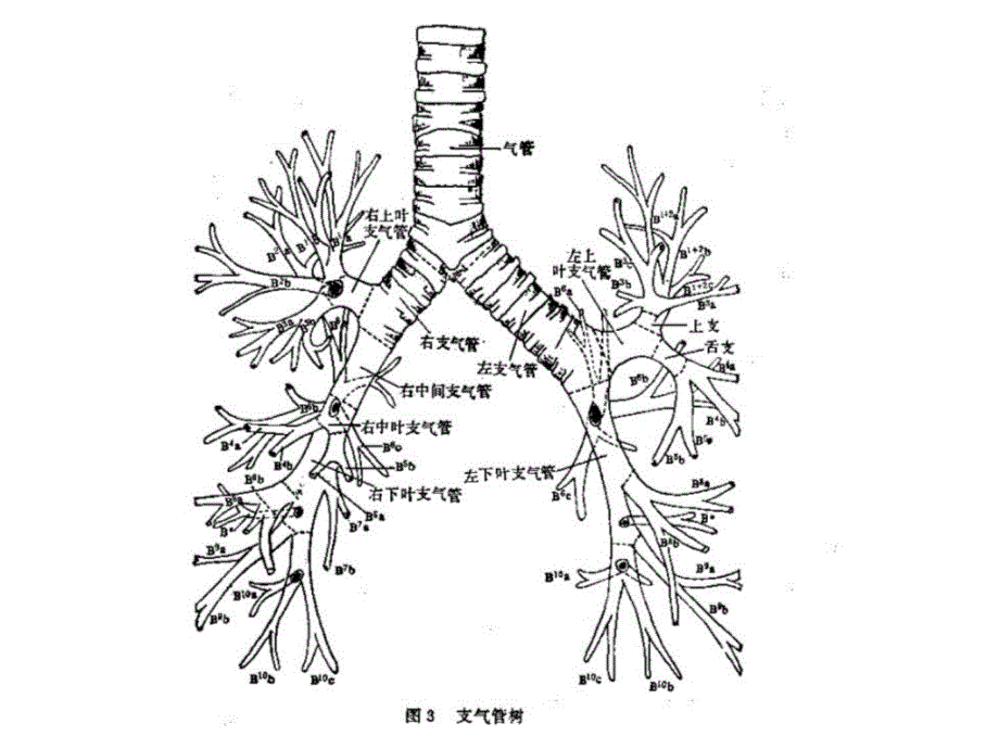 纤维支气管镜解剖讲课资料_第3页