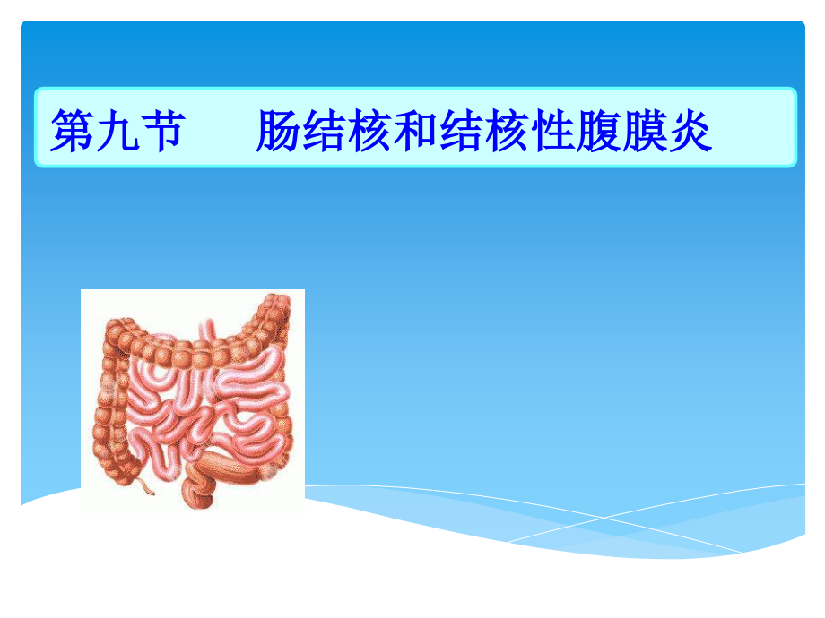 肠结核和结核性腹膜炎(2)课件PPT_第2页