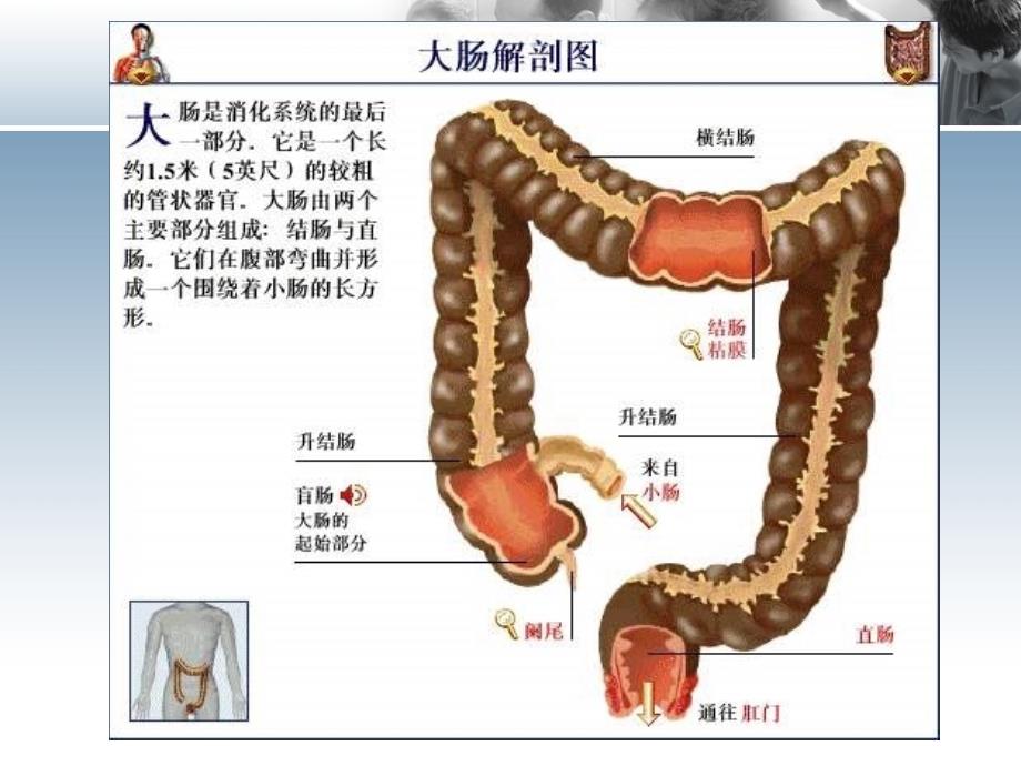 直肠癌的护理【】课件PPT_第2页