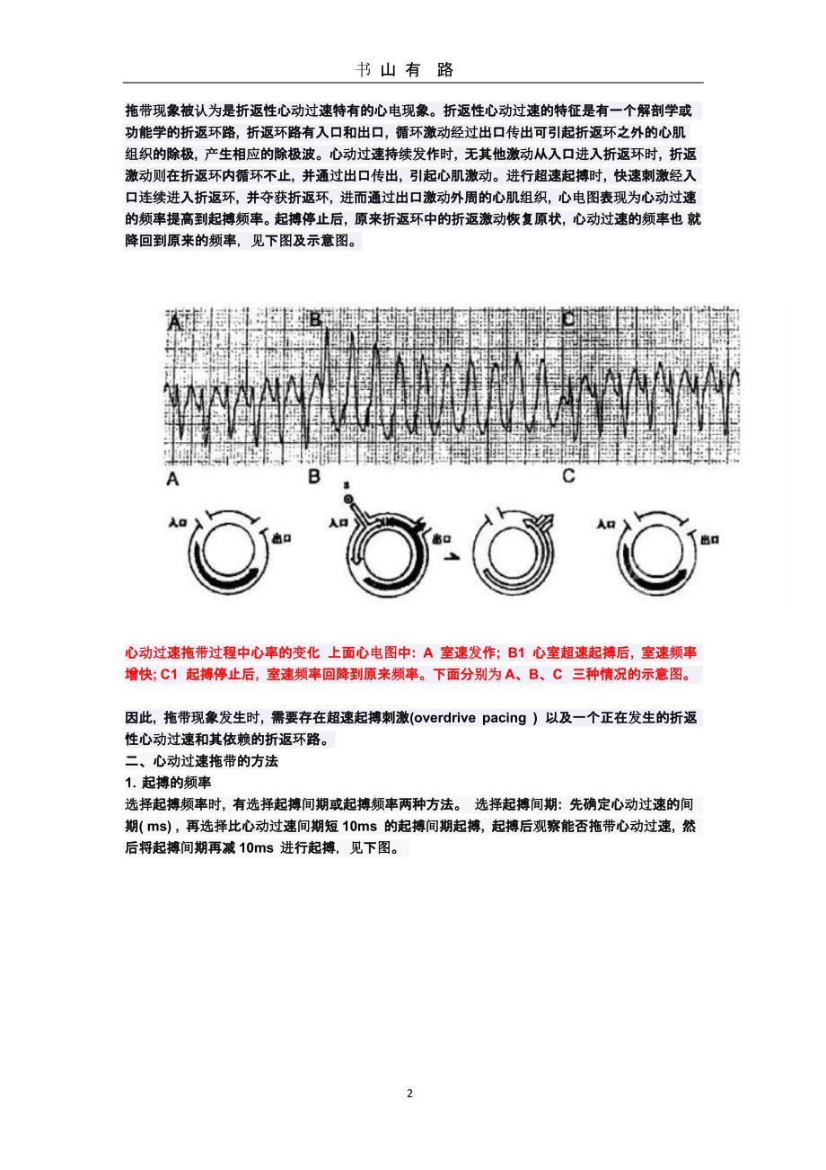 心脏电生理介入扫盲贴(6)------拖带与折返（5.28）.pptx_第2页