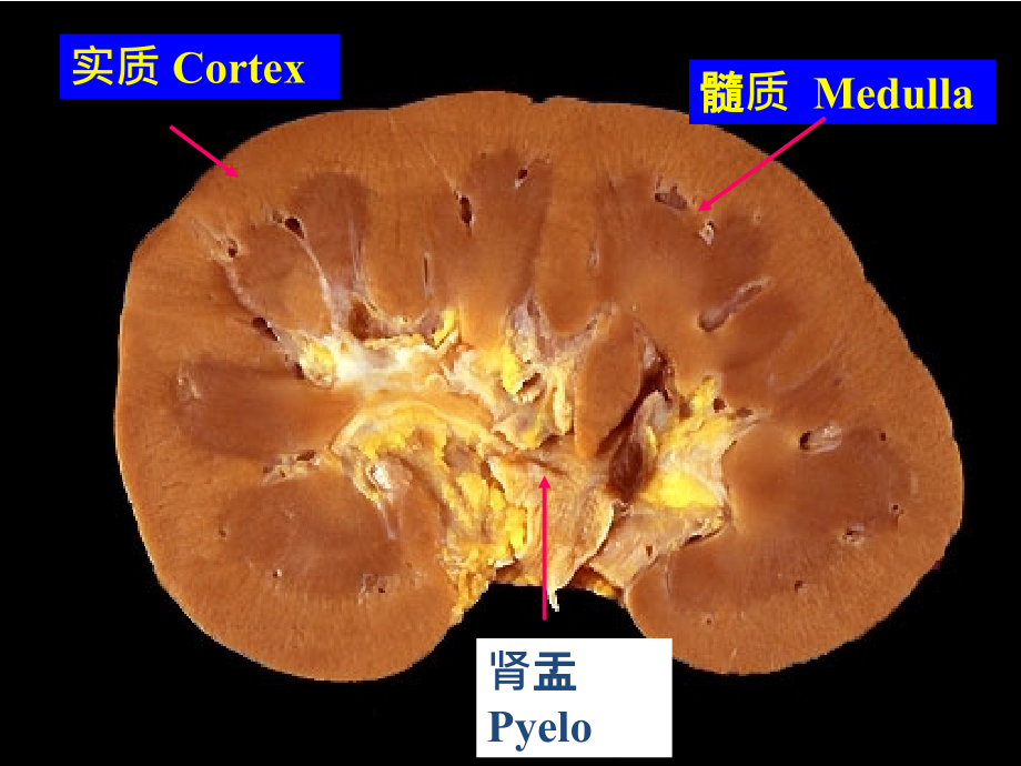 病理学第9章泌尿系统疾病1课件PPT_第3页