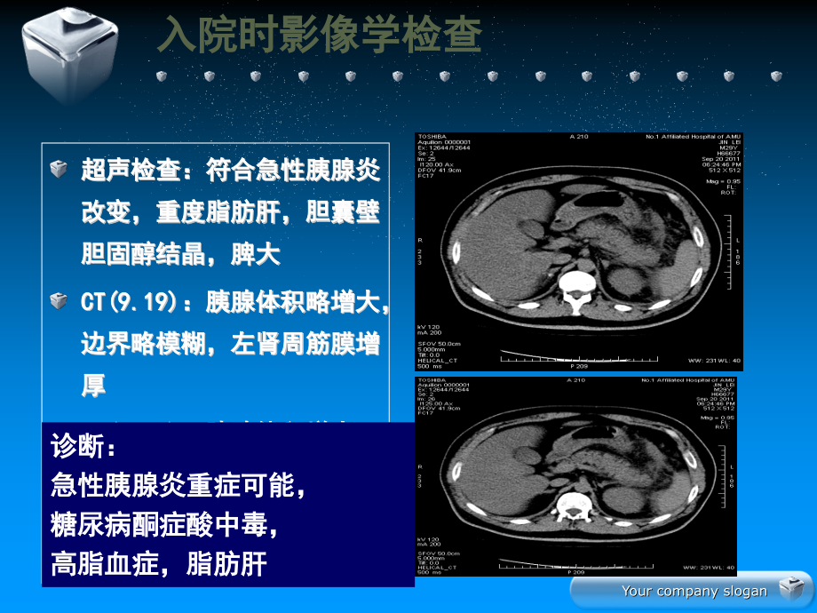 床病例看急性胰腺炎病情评估与分类课件PPT_第4页