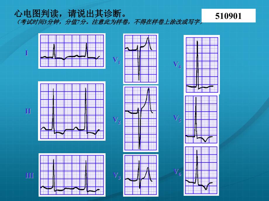 2020年最新心电图试题集[规培资料]_第1页