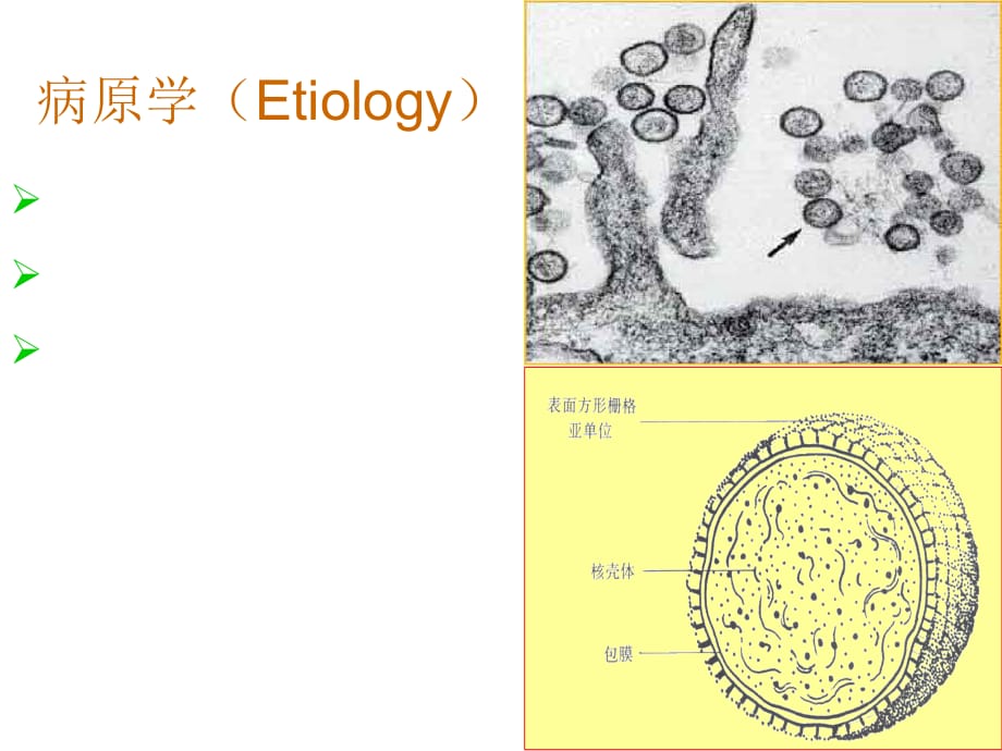 流行性出血热课件课件PPT_第3页
