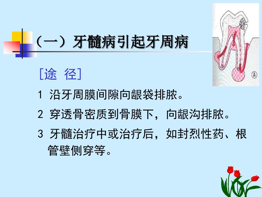 牙周炎伴发病变、牙周病治疗课件PPT_第4页