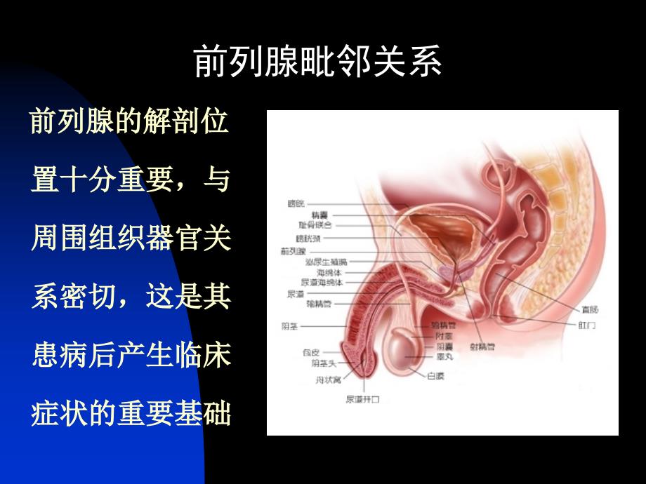 前列腺炎-(演示)课件PPT_第4页