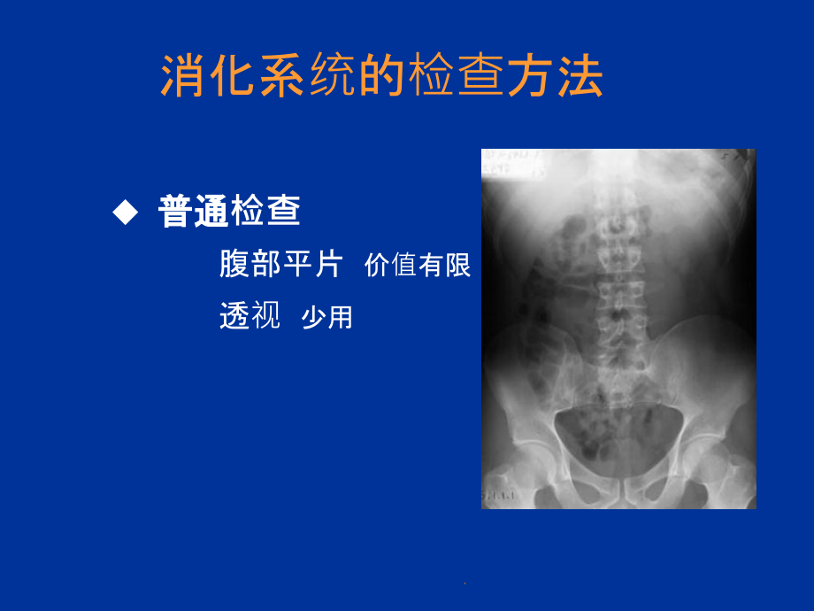 消化系统影像诊断ppt课件_第2页