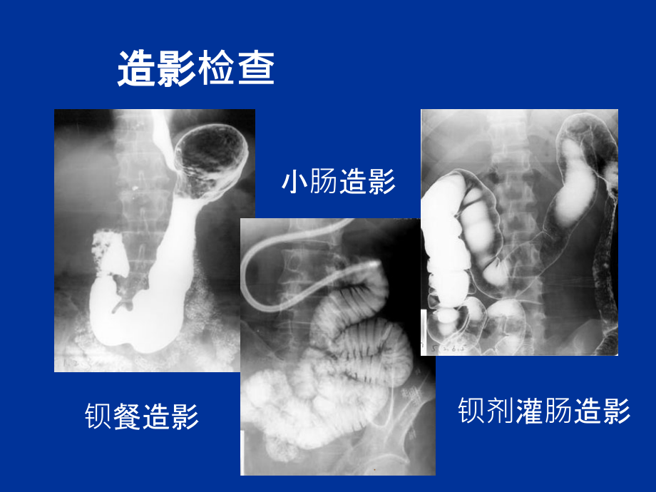 消化系统影像诊断ppt课件_第4页