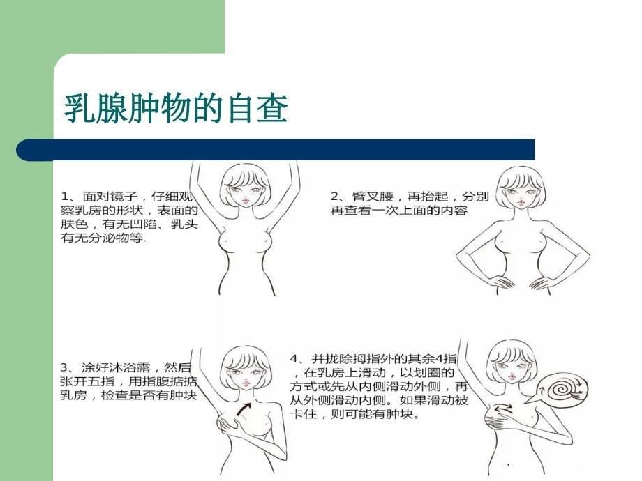 乳腺癌诊疗流程ppt课件_第5页