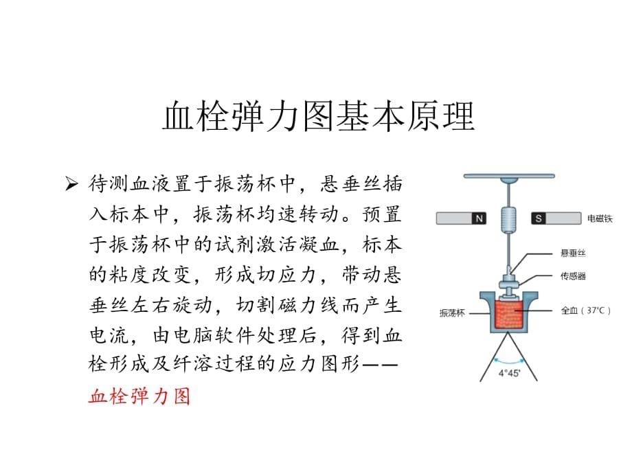 血栓弹力图-临床应用-301演示教学_第5页