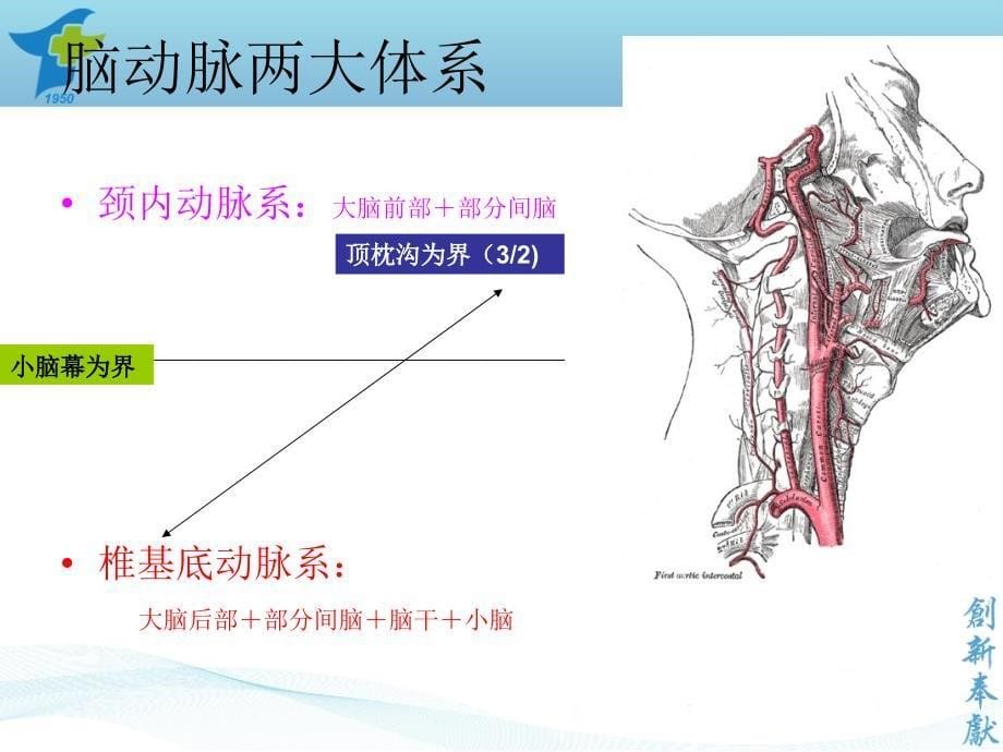 小脑出血诊疗规范.ppt_第5页