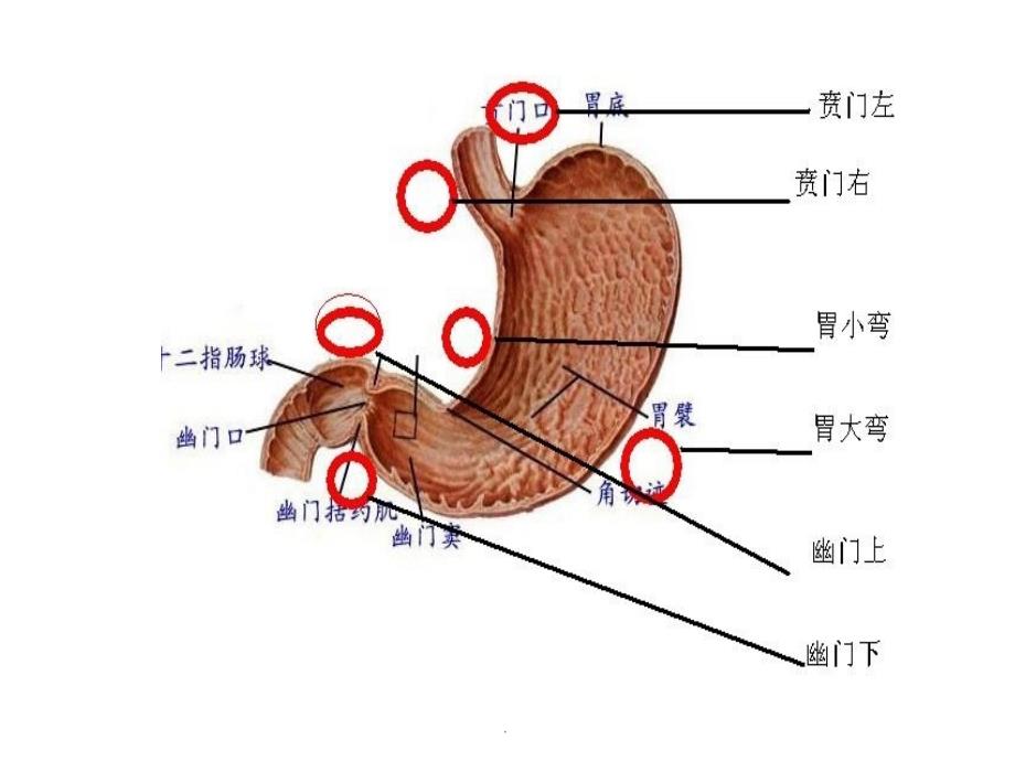 胃癌术后并发症的护理ppt课件_第2页