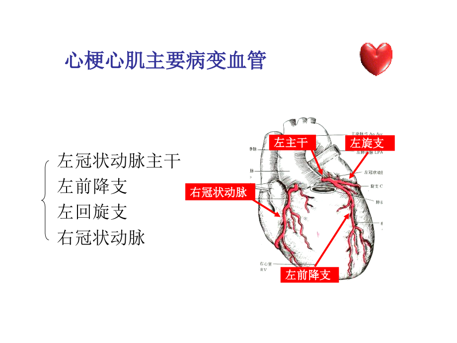 《精编》不典型心梗的心电图诊断培训讲义_第4页