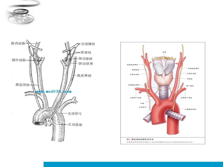 主动脉置换术课件PPT_第3页