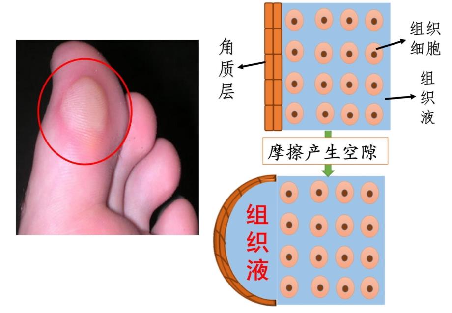 一轮复习——内环境稳态公开课知识讲解_第3页