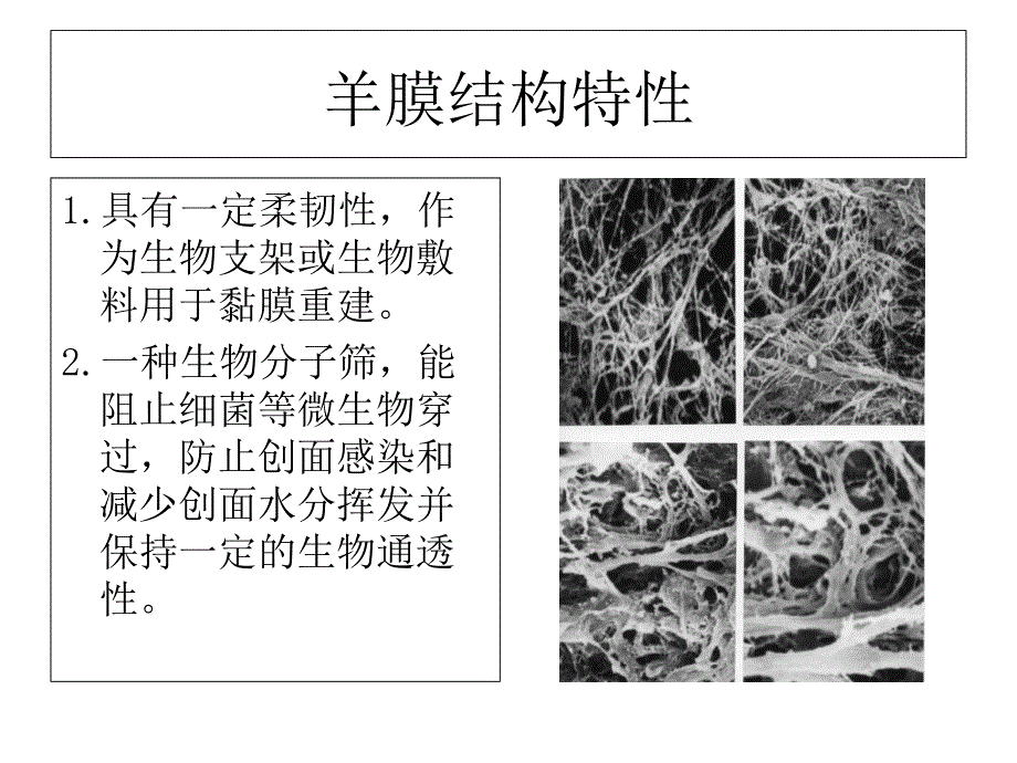 新型凹凸面生物羊膜介绍上课讲义_第4页