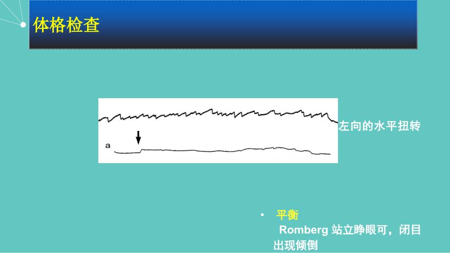 周围性眩晕病例分析与诊疗课件PPT_第4页