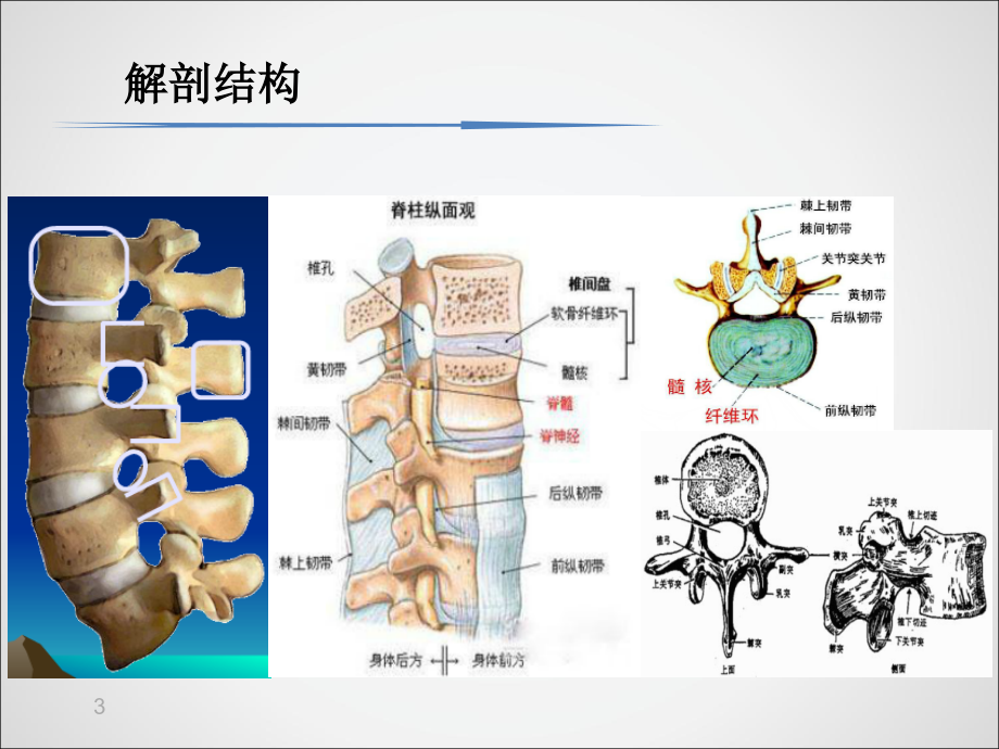 腰椎间盘突出的诊治课件PPT_第4页