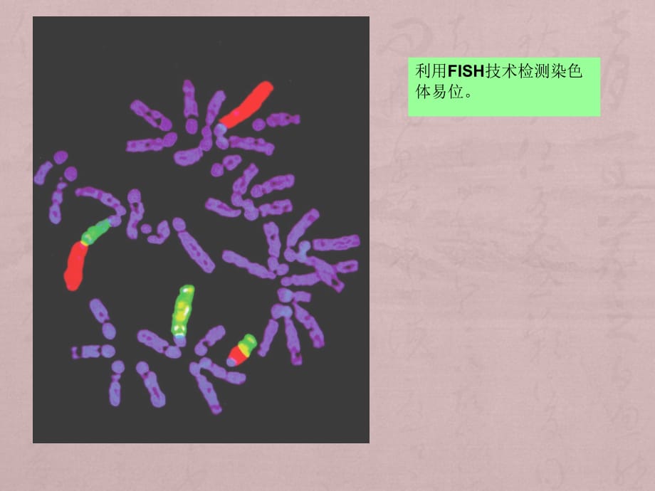 遗传病诊断及产前诊断课件PPT_第3页