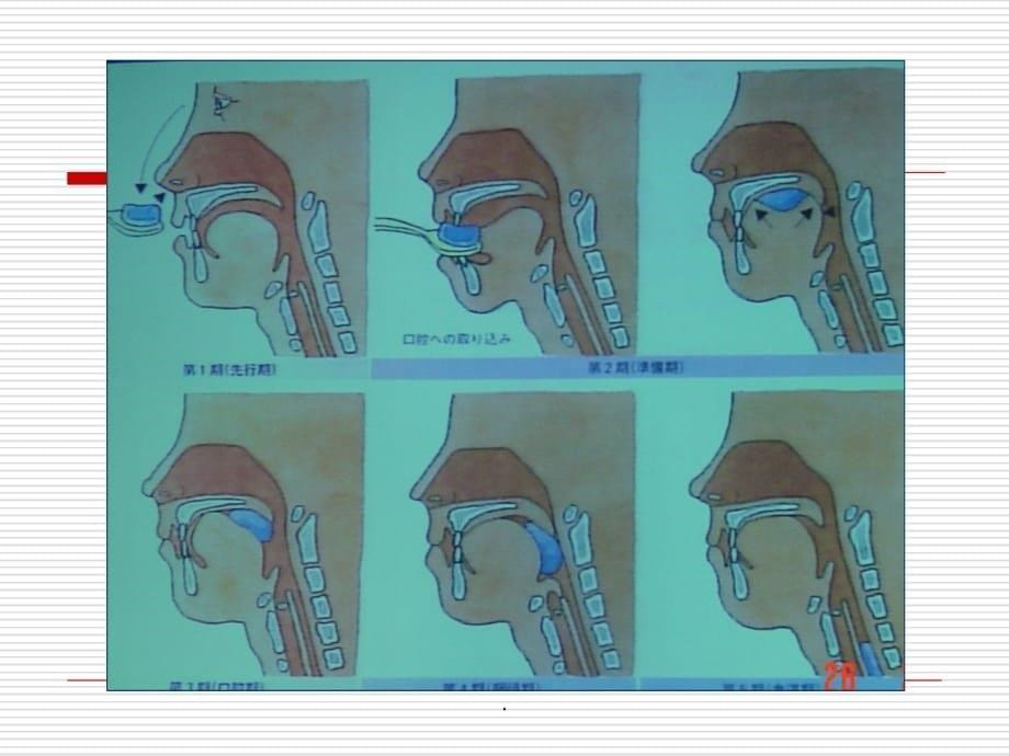 吞咽障碍的康复训练ppt课件_第5页