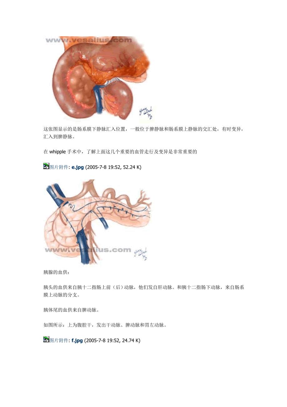 胰十二指肠切除术手术记录.doc_第3页