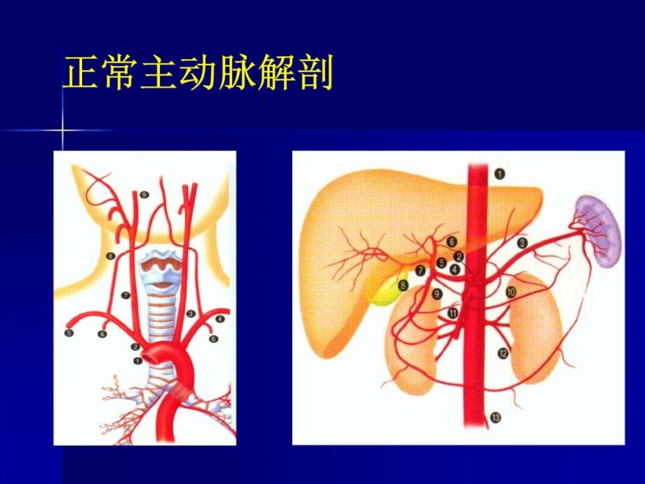 主动脉夹层及腹主动脉瘤CTA影像教学提纲_第3页