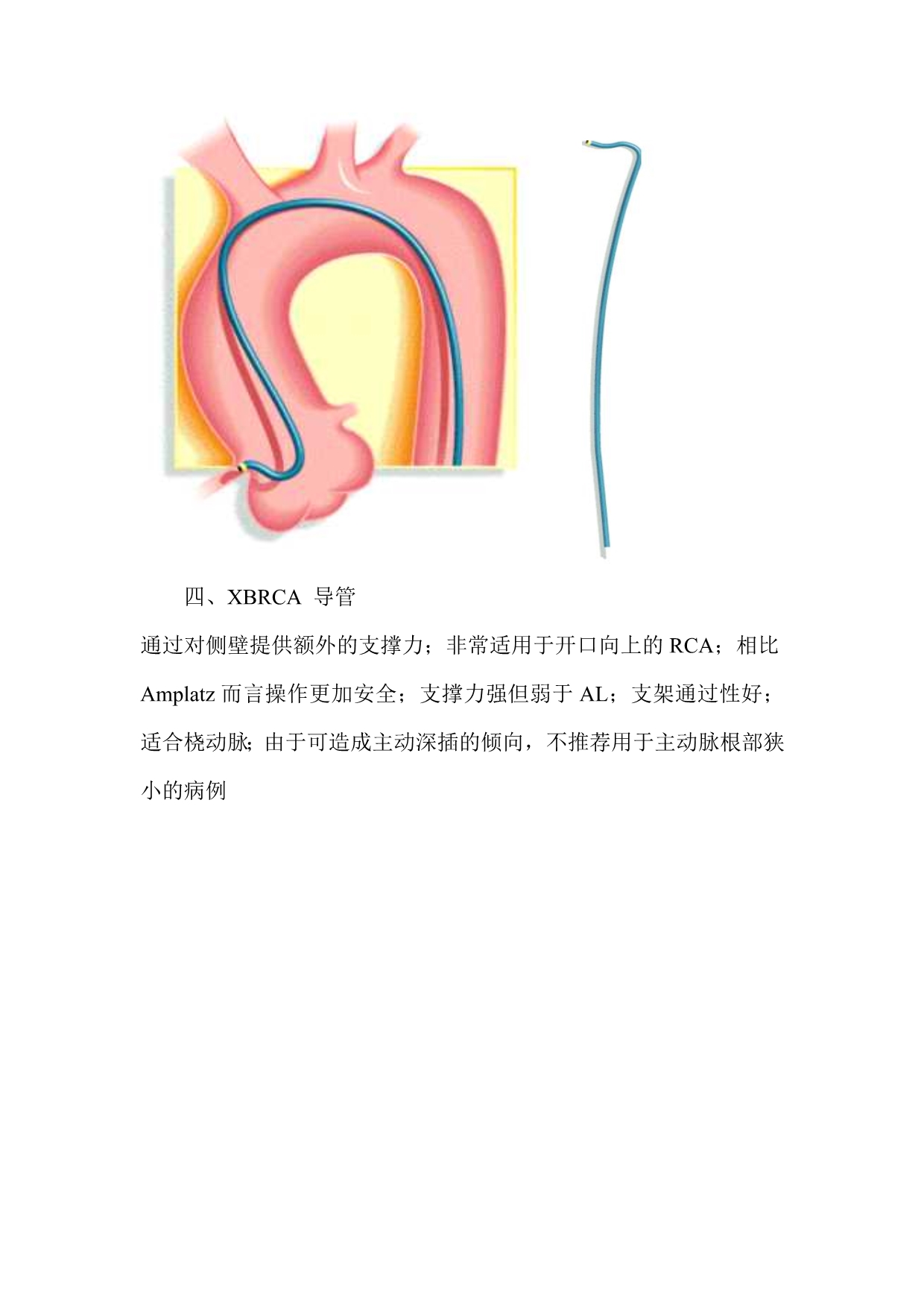 右冠状动脉指引导管的选择.doc_第3页