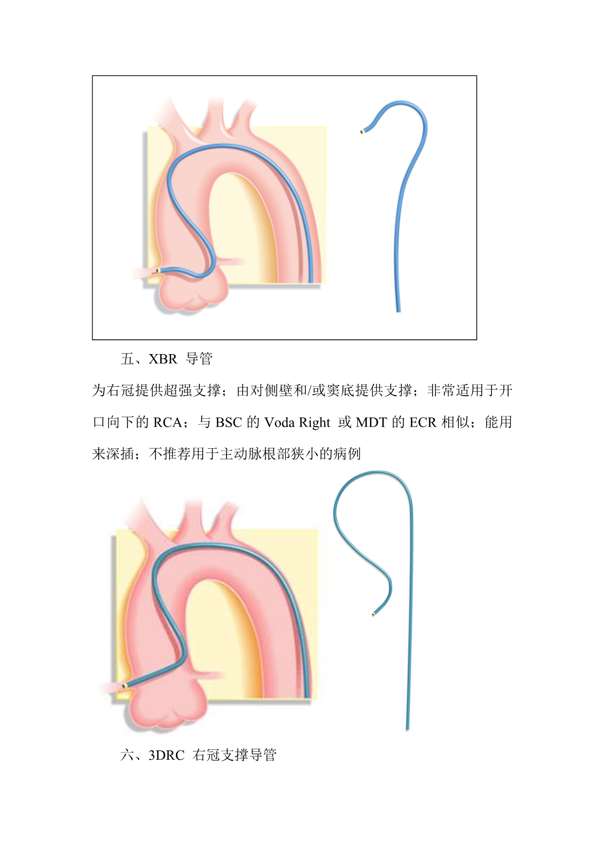 右冠状动脉指引导管的选择.doc_第4页