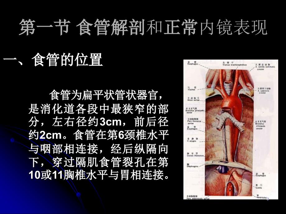 食管疾病(课堂PPT)_第3页