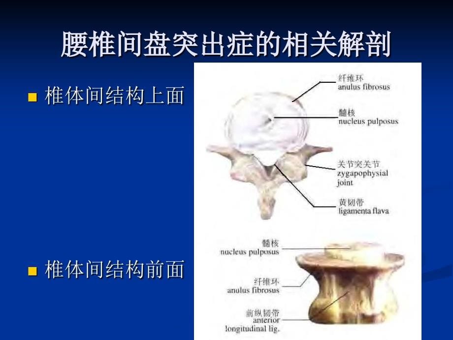 腰椎间盘突出症的诊断、鉴别诊断与分型ppt课件_第5页