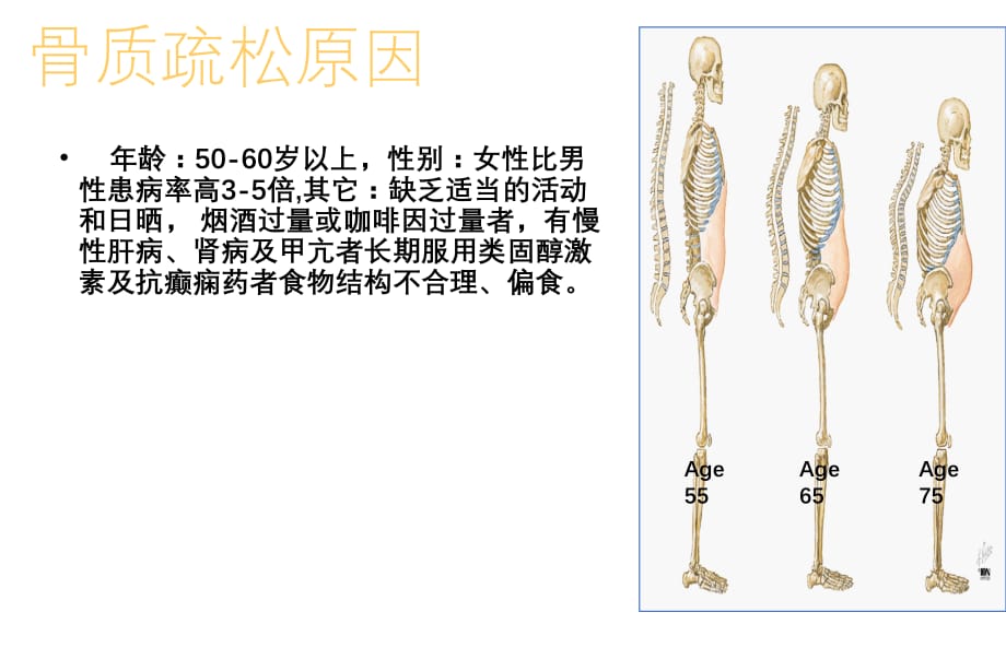 骨质疏松症的防治ppt（5.4）_第5页