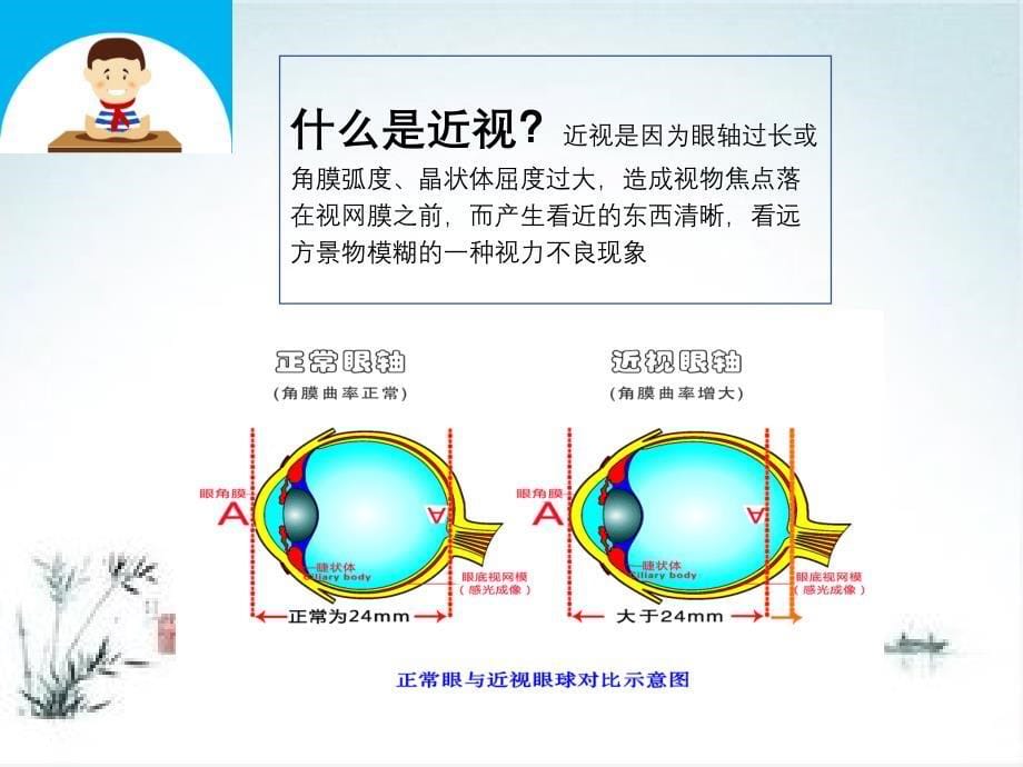 科学防控近视（5.4）_第5页