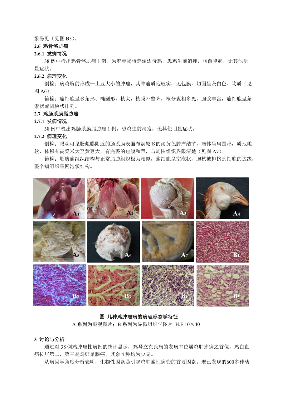 几种鸡肿瘤病的病理学形态学观察_第3页