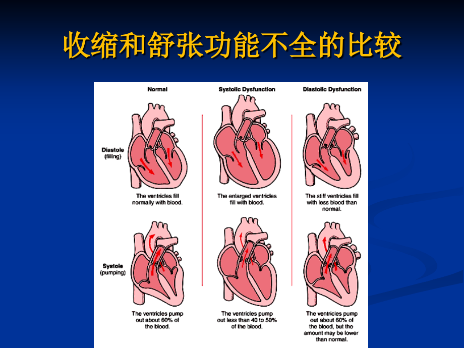 内科学心力衰竭PPT课件_第4页