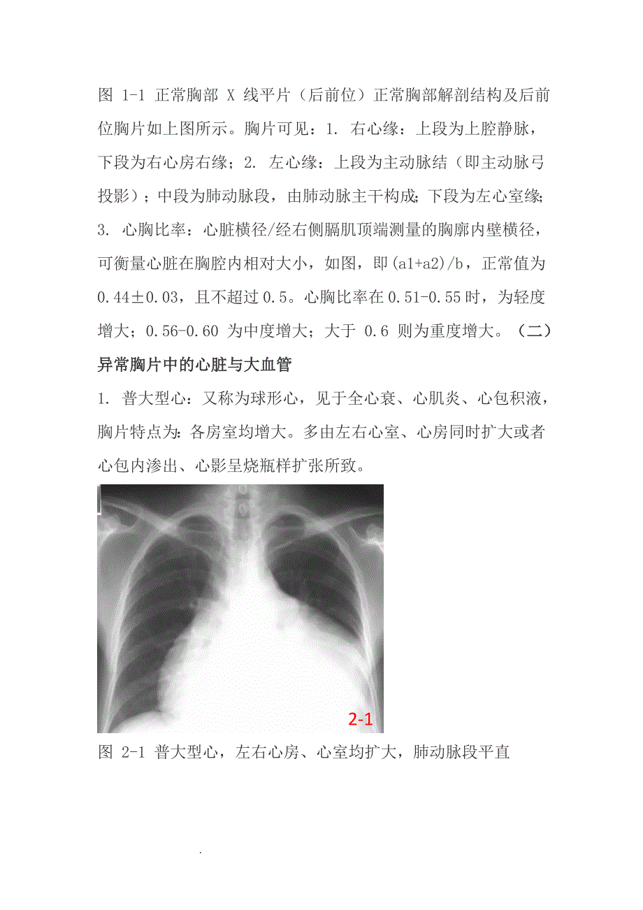 精选-常见的X线胸片_第2页