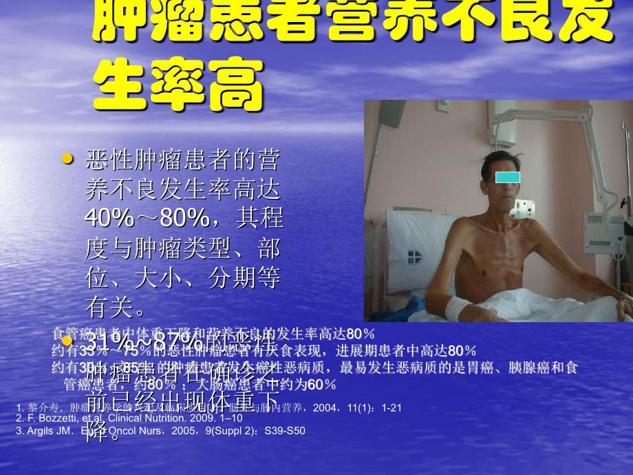 肿瘤病人的营养治疗ppt课件_第3页