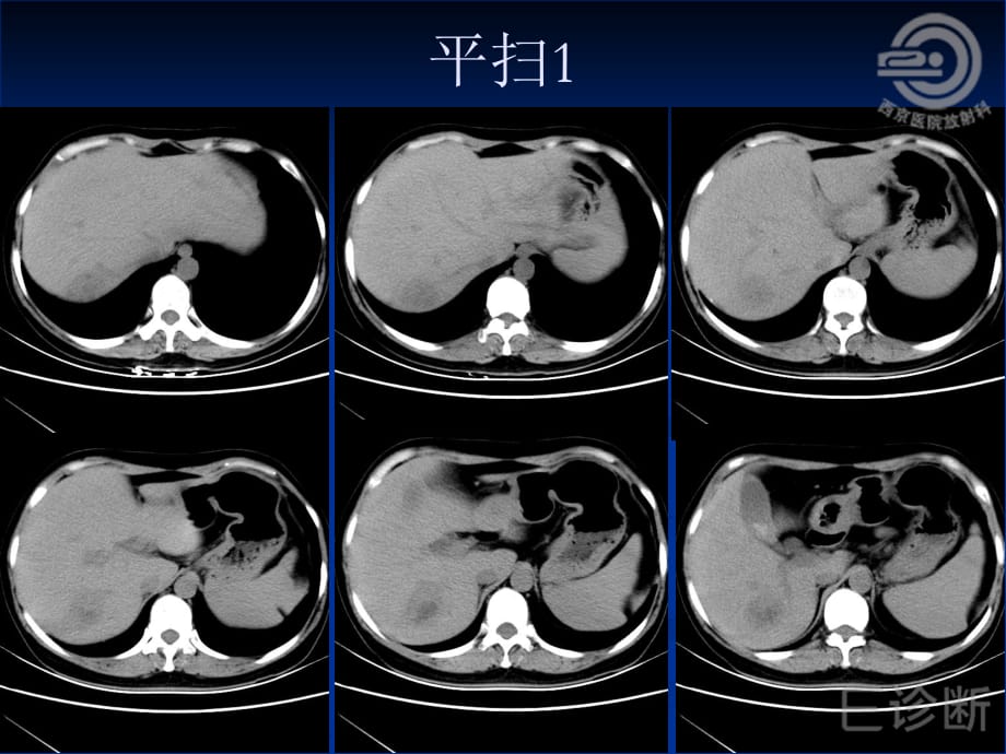 E诊断西京病例六结果ppt课件_第4页