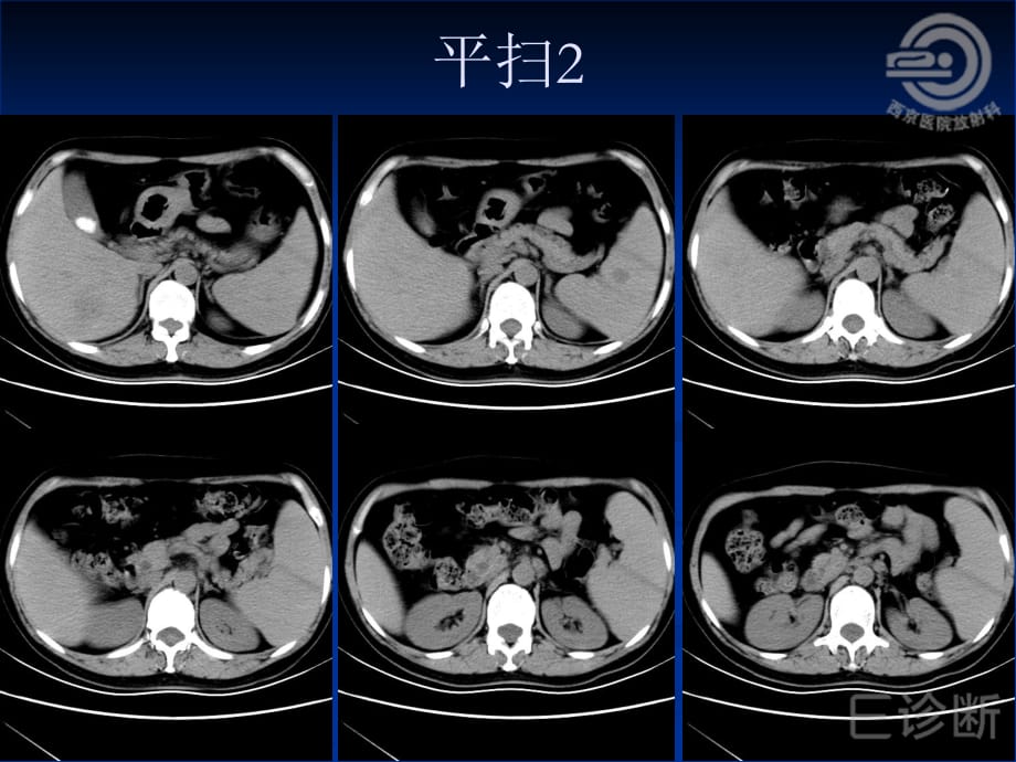 E诊断西京病例六结果ppt课件_第5页