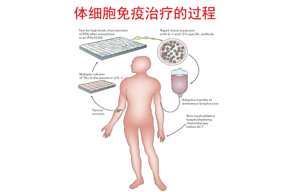 体细胞免疫治疗联合肿瘤常规治疗的基本原则一ppt课件_第3页