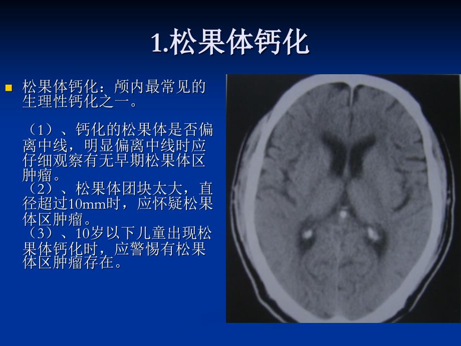 颅内钙化的影像学分析ppt课件_第4页