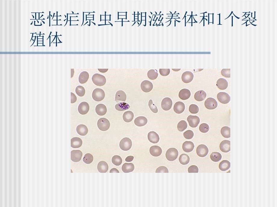 外周血涂片中的各种疟原虫PPT课件_第5页