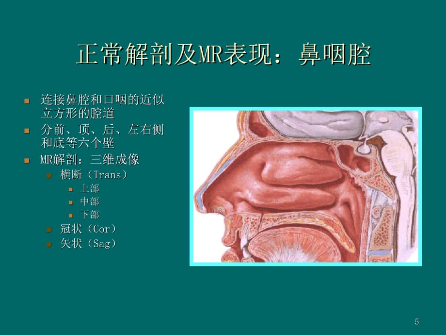 鼻咽癌的诊断医学课件_第5页